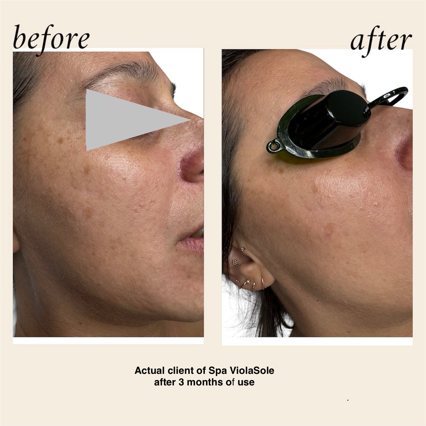 Advanced Age-Defense Serum