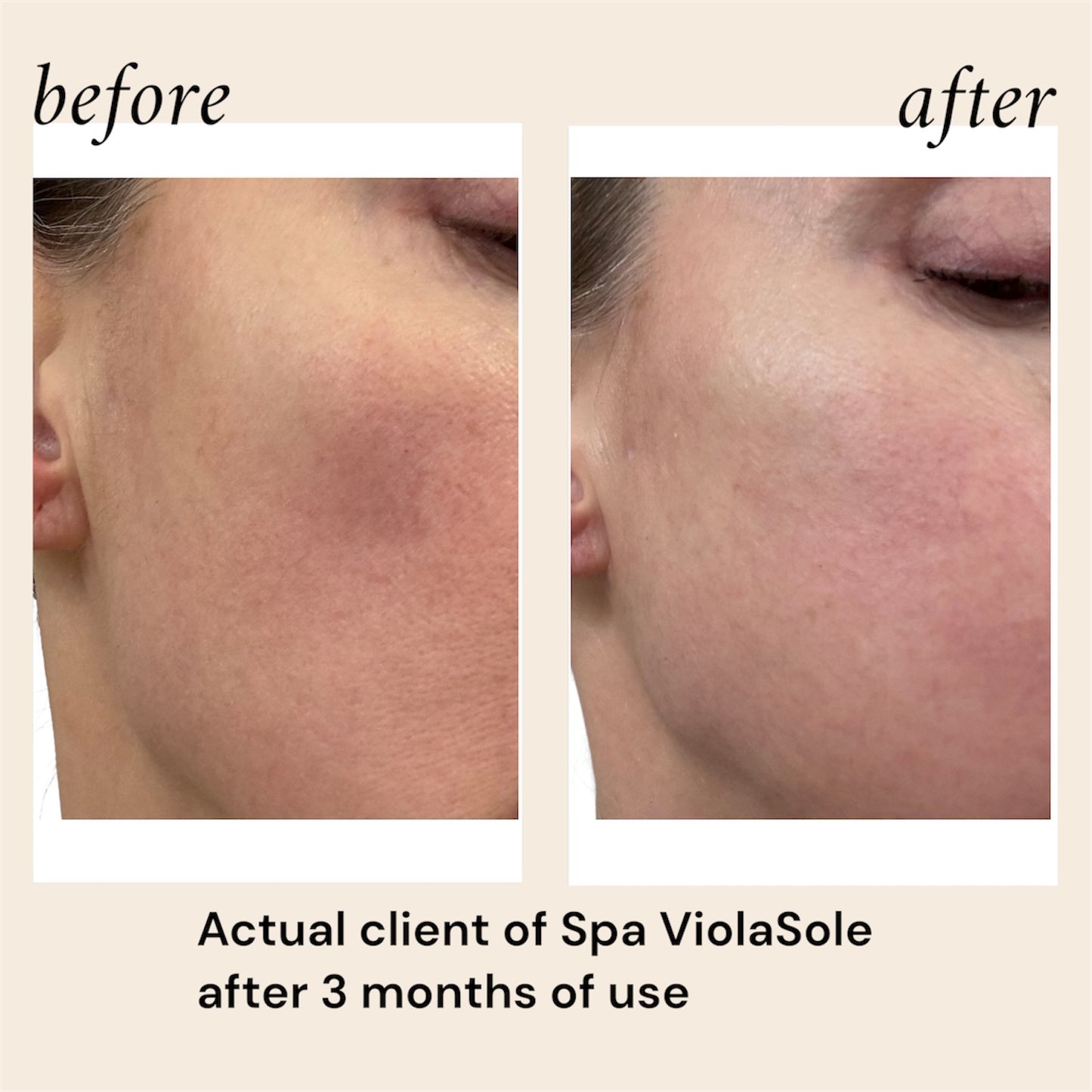 Advanced Age-Defense Serum