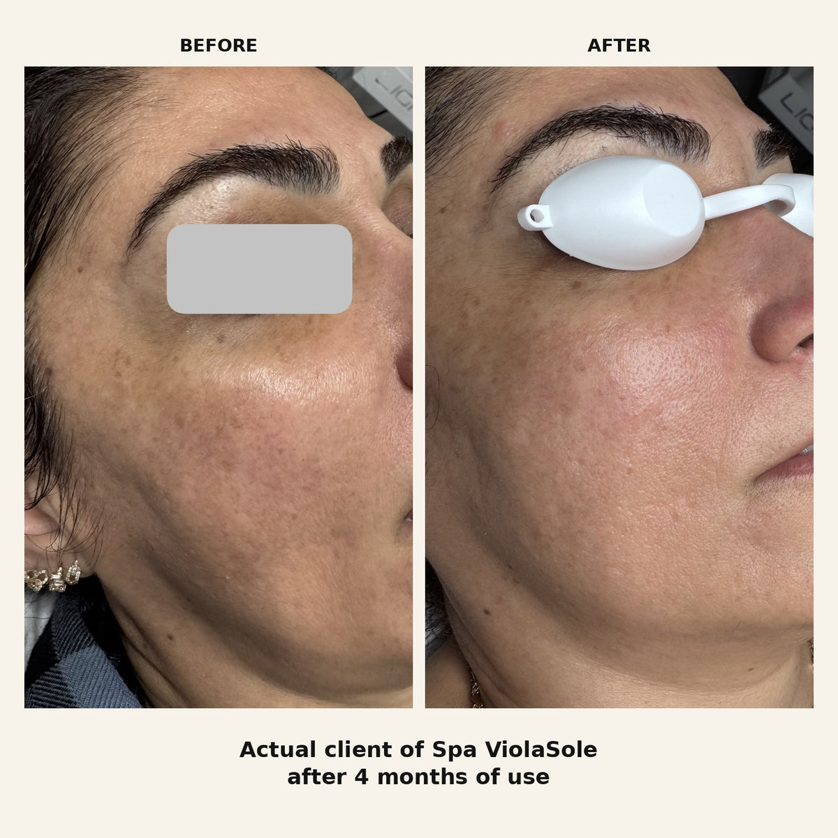 Advanced Age-Defense Serum
